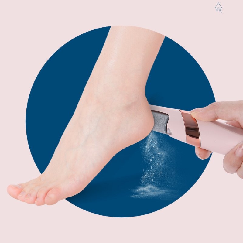 COMFMET™ - Rechargeable Callus Foot Remover